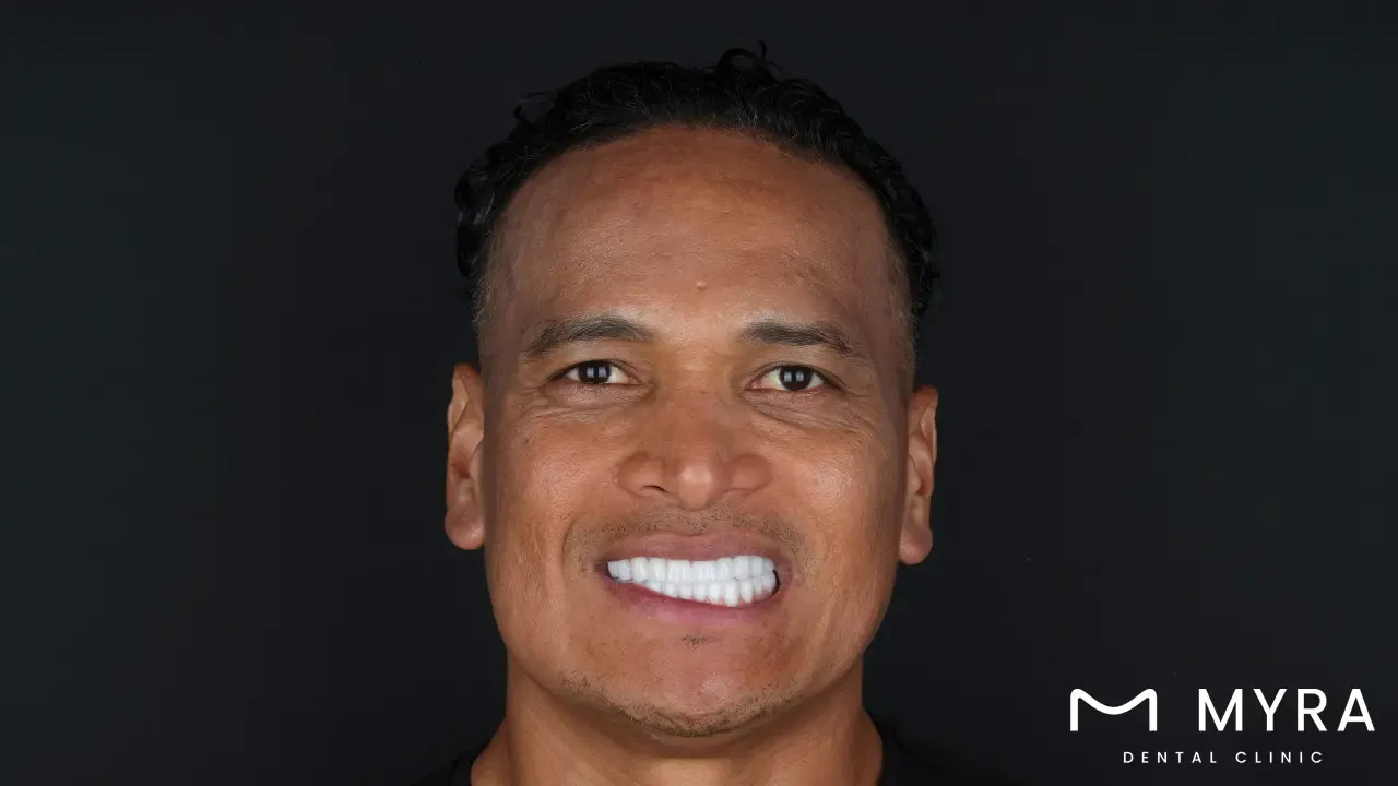 Is turkey also economical for special dental procedures like implants?