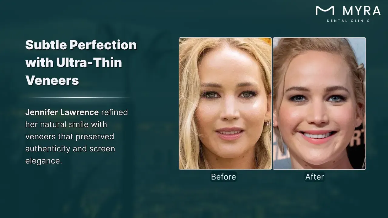 jennifer lawrence's smile