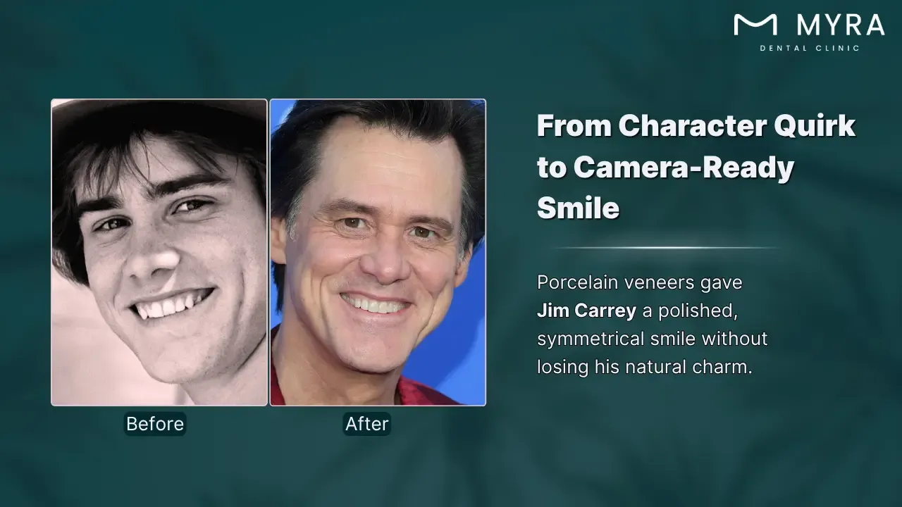 jim carrey's chipped tooth