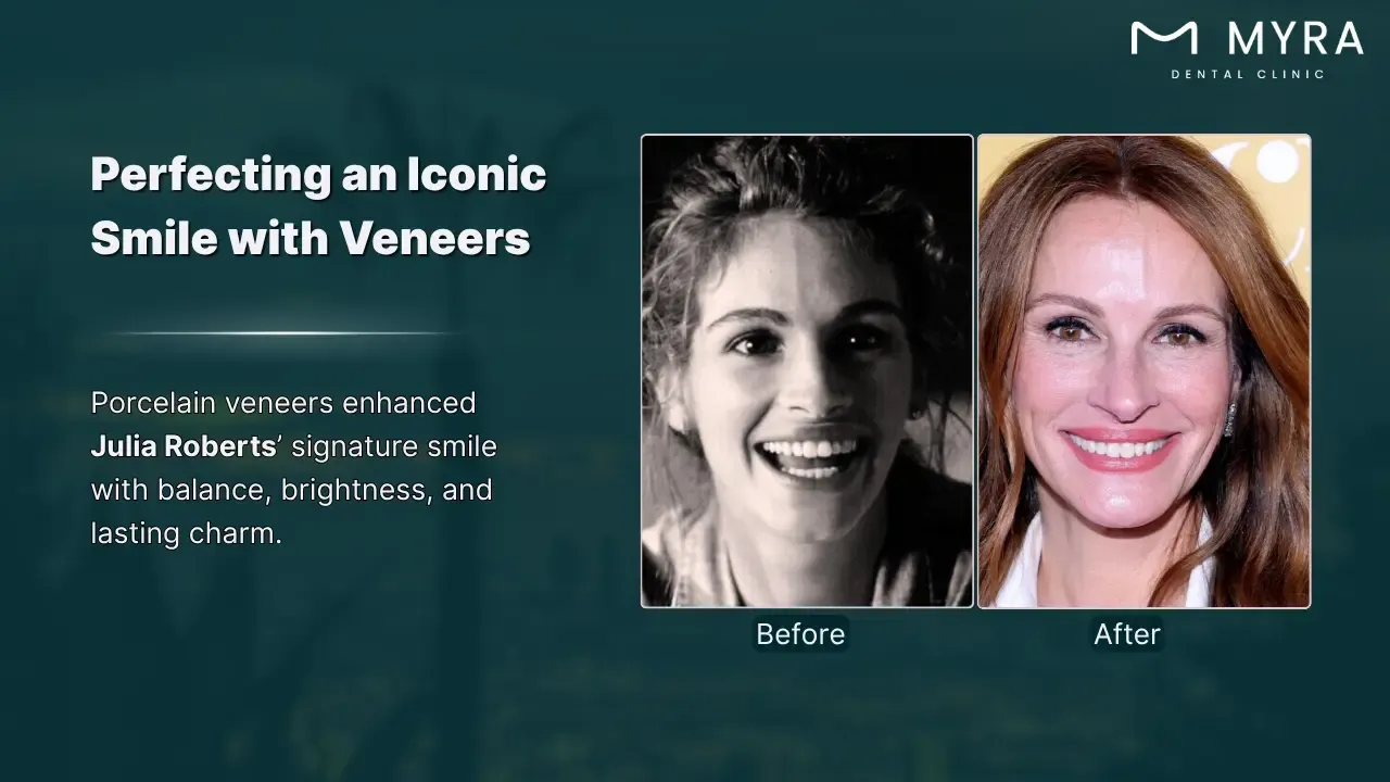 julia roberts' iconic smile