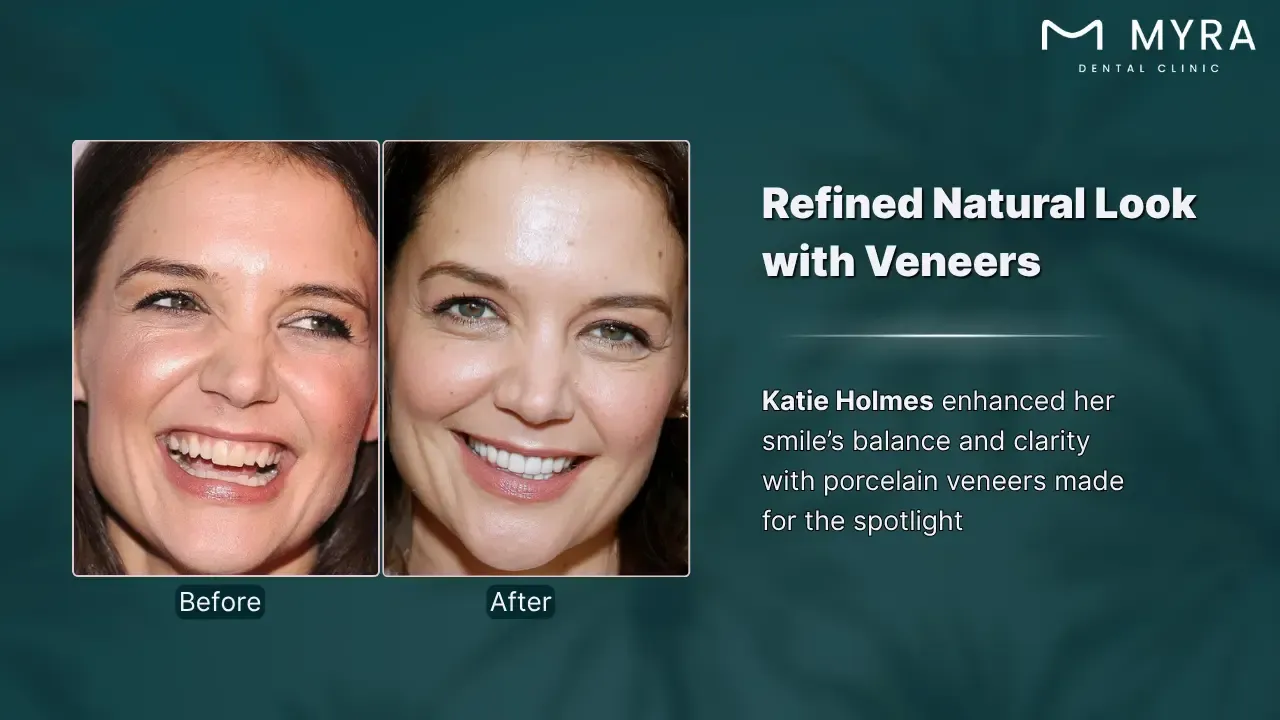 katie holmes' smile refinement