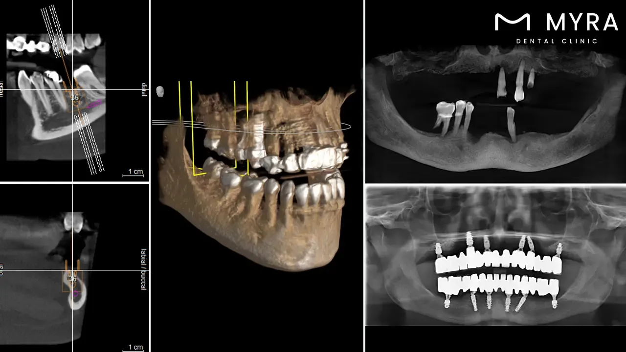 Learn about the dental treatment process and planning