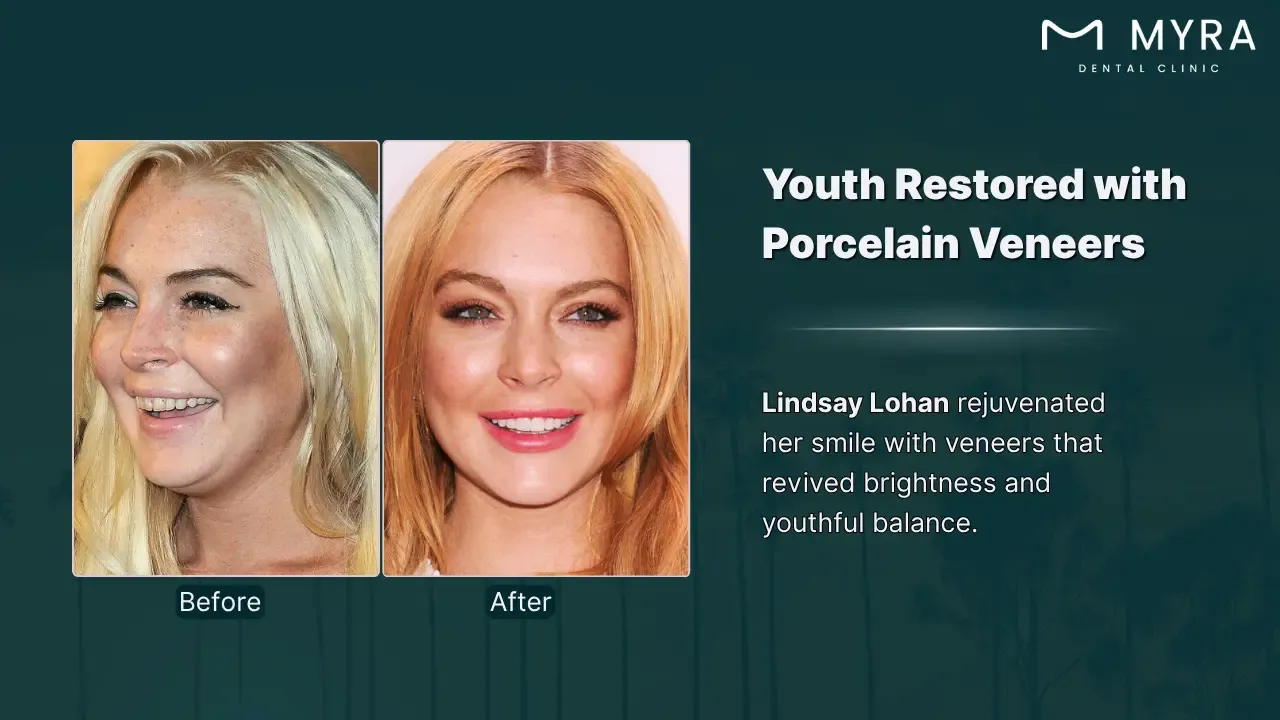 lindsay lohan's smile restoration
