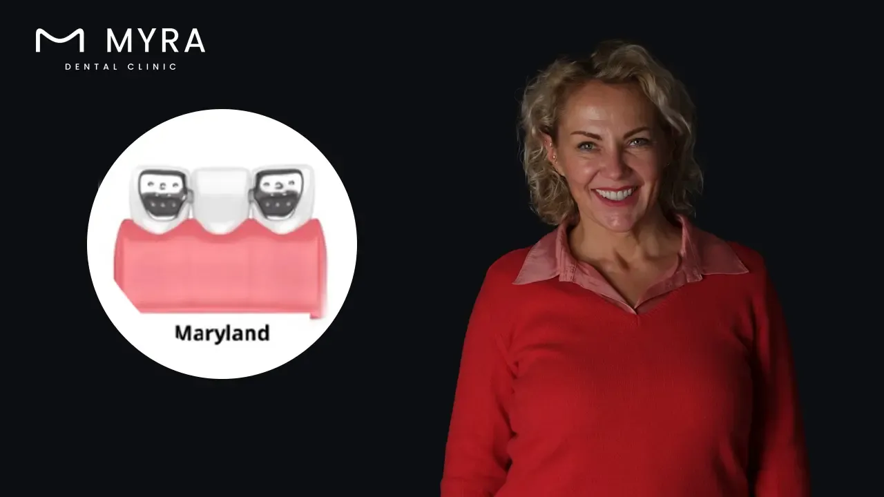 maryland dental bridge