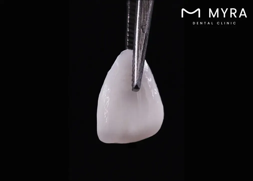 material quality