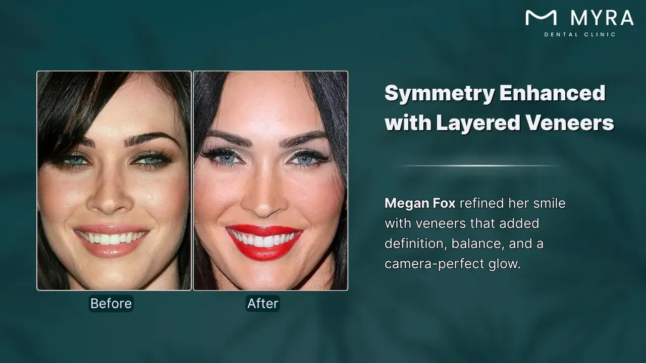megan fox's hollywood smile