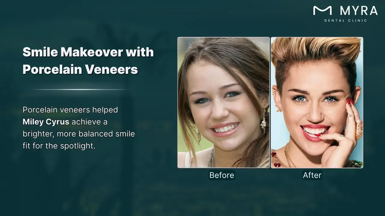 miley cyrus's smile transformation