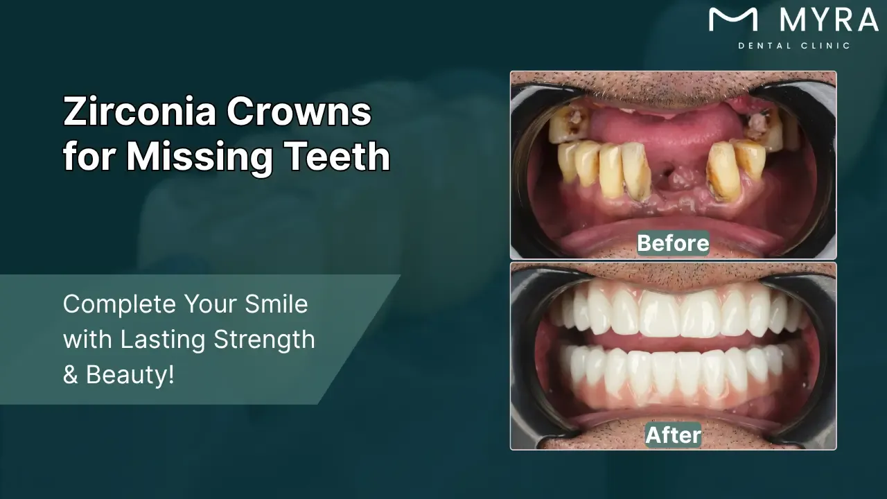 missing teeth