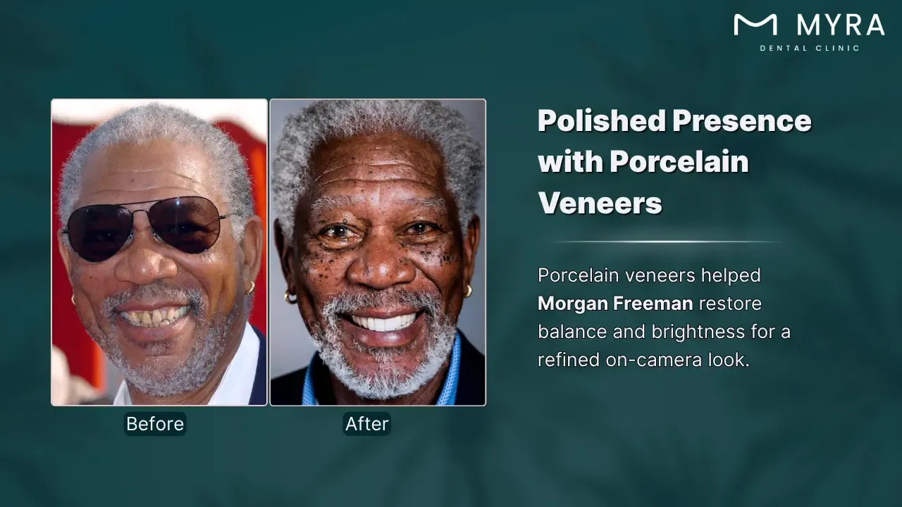 morgan freeman's smile rejuvenation