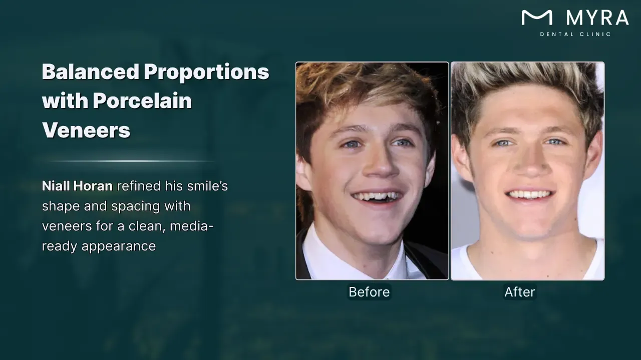 niall horan's orthodontic journey