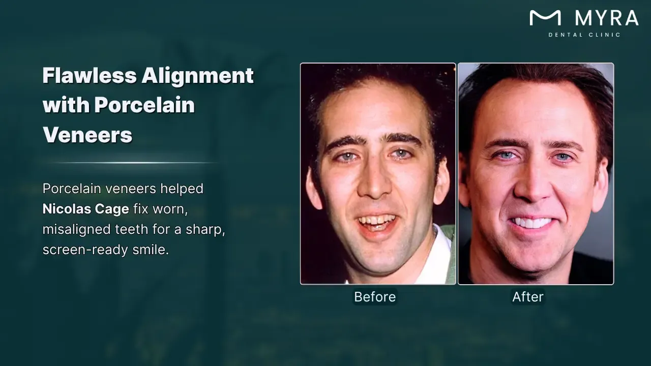 nicolas cage's dental commitment