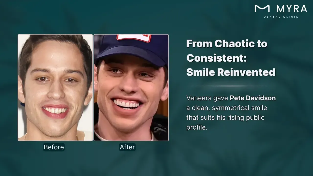 pete davidson's smile