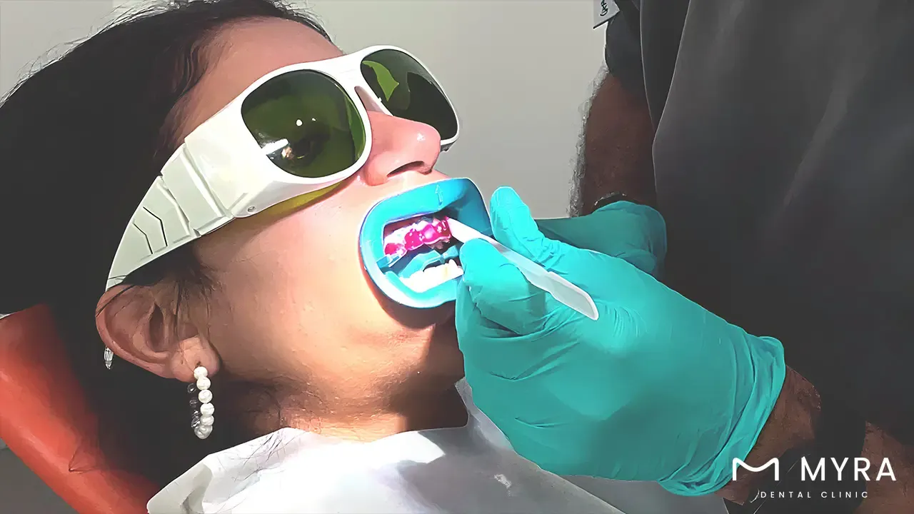 professional-whitening.webp