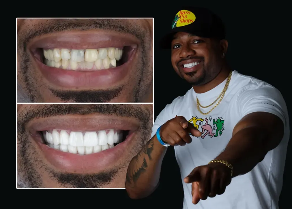 Root canal treatment in turkey: Definition, importance, types, procedure, and advantages