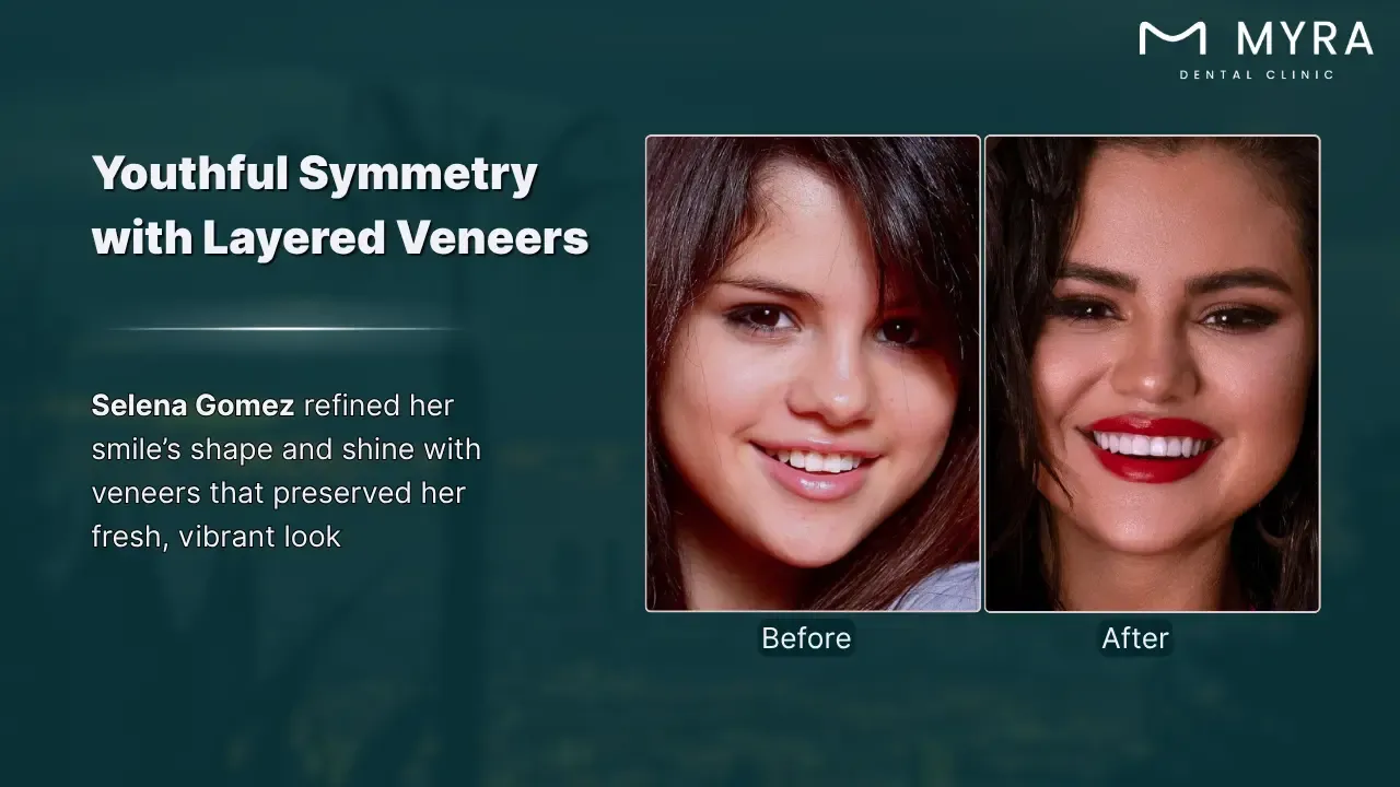 selena gomez's polished smile