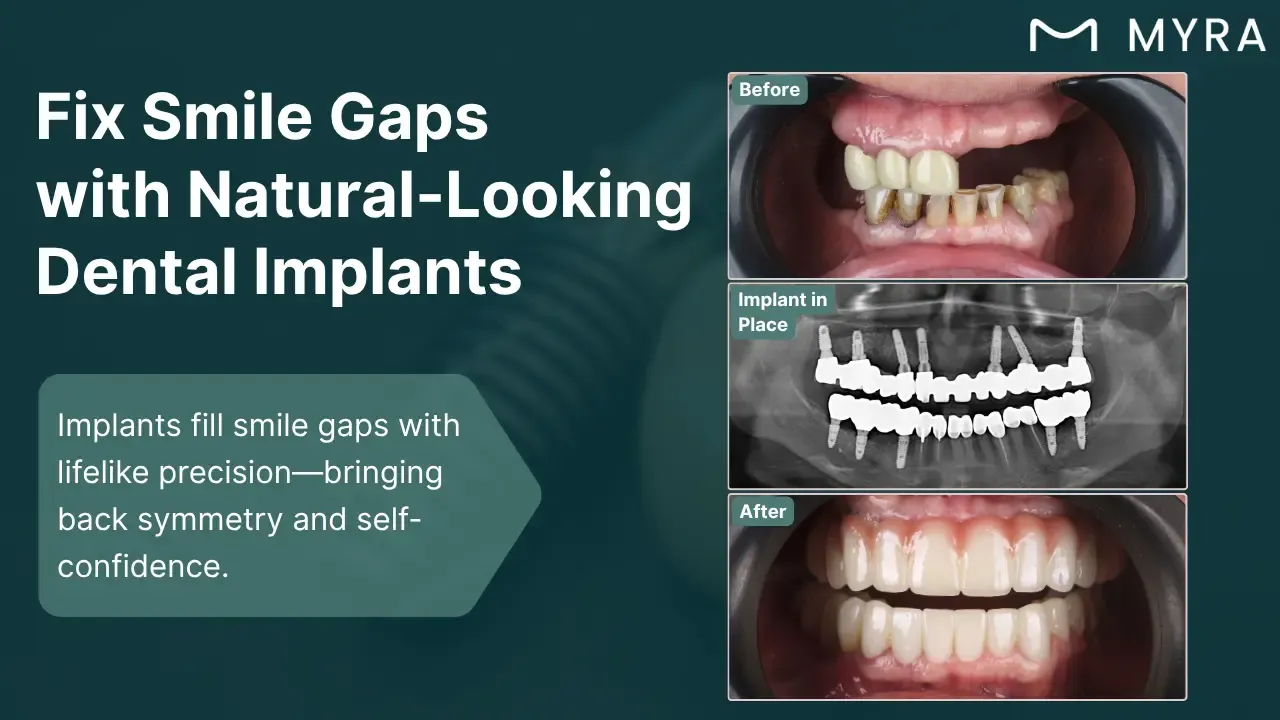 smile-gaps-and-aesthetic-concerns.webp