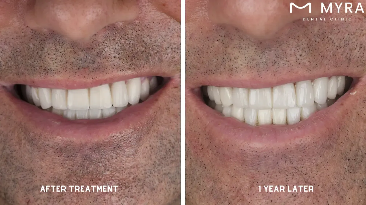 Smoking or using tobacco products