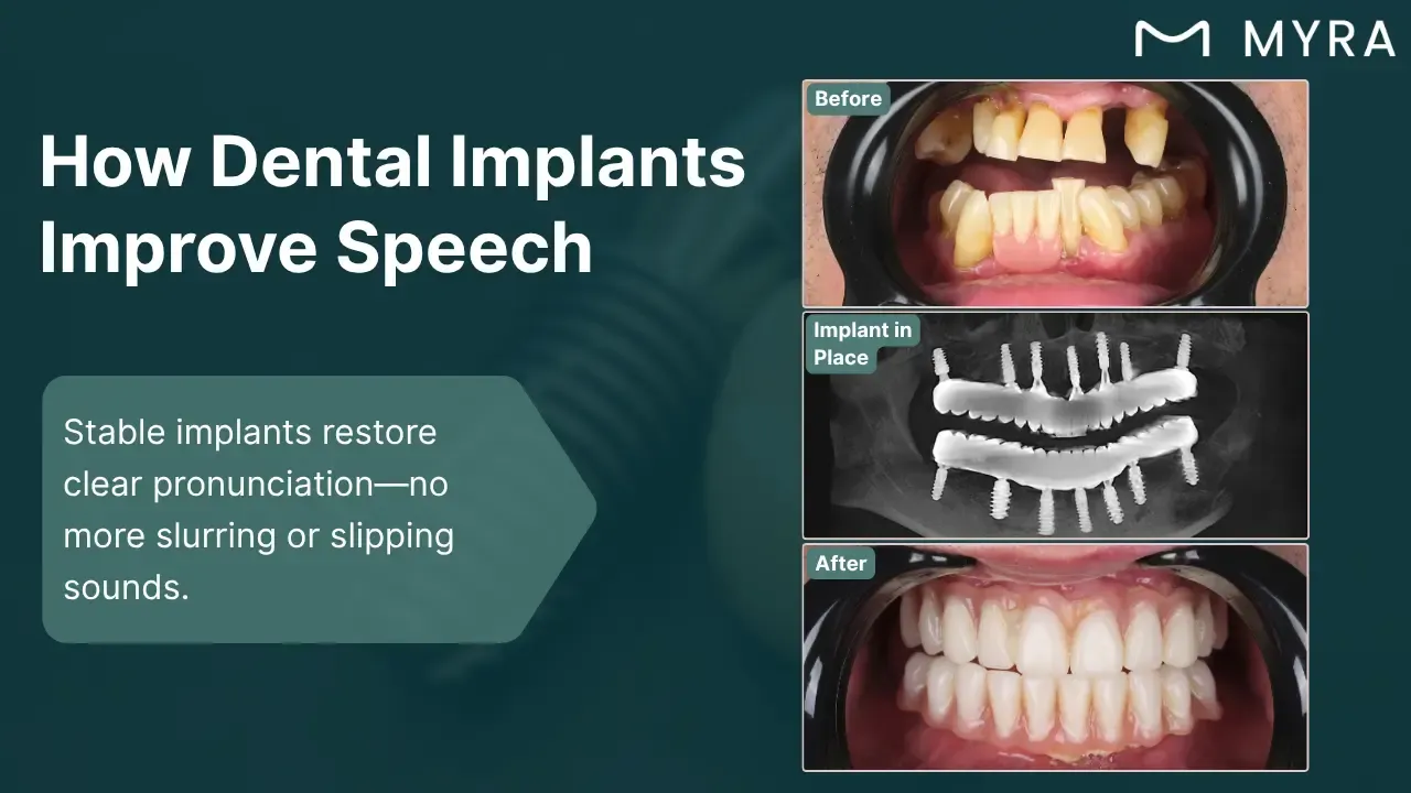speech-impairments.webp