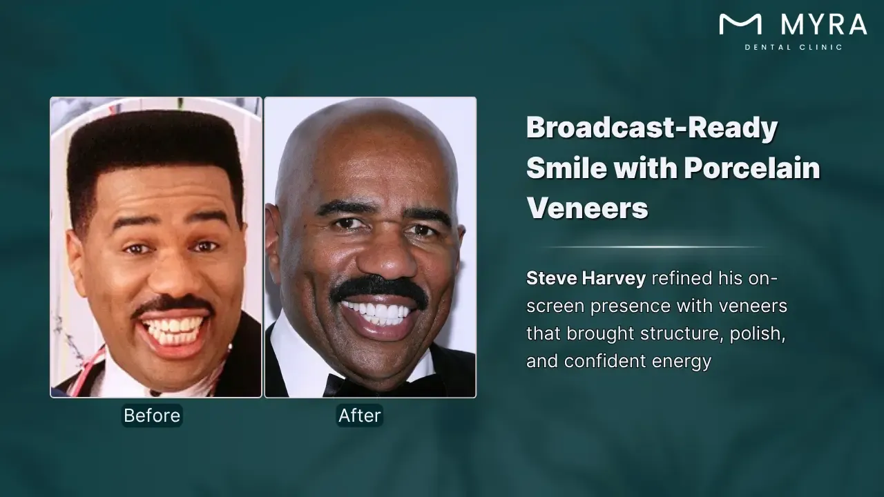 steve harvey's signature smile