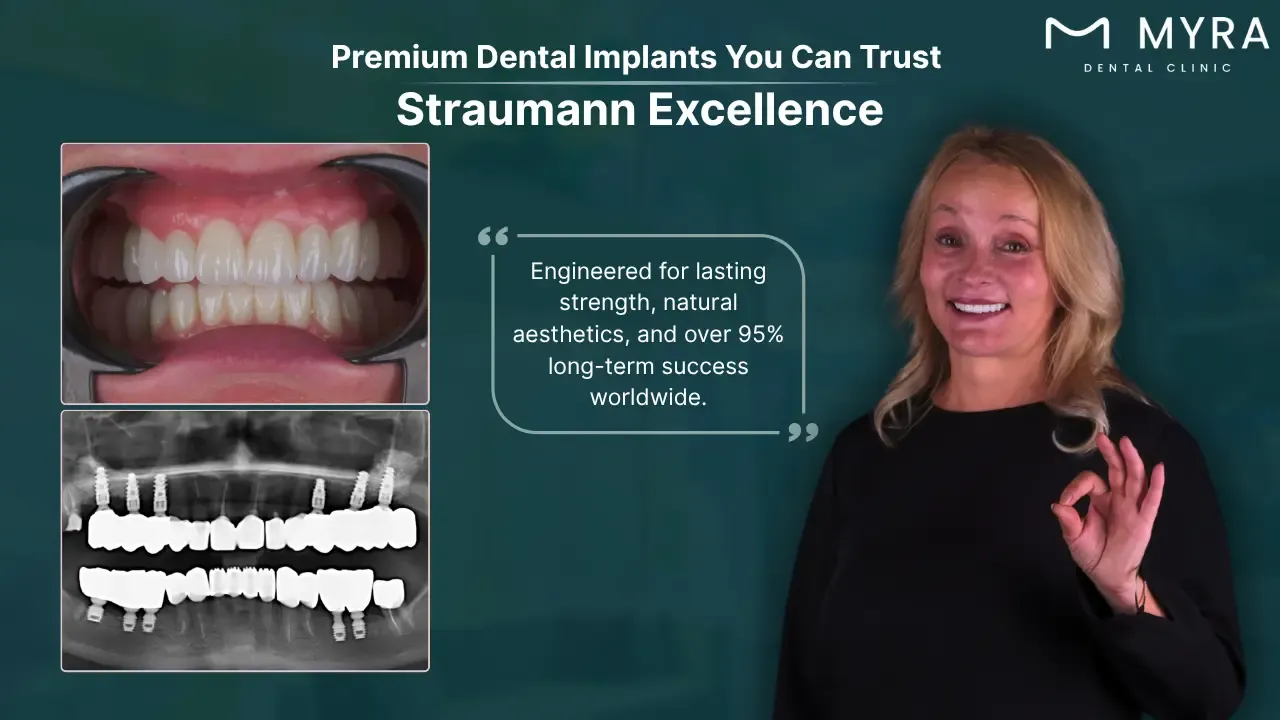 straumann-implants-types-features-and-cost.webp