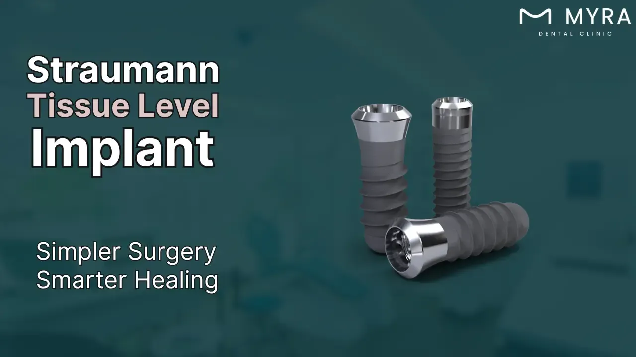 straumann-tissue-level-implant-line.webp