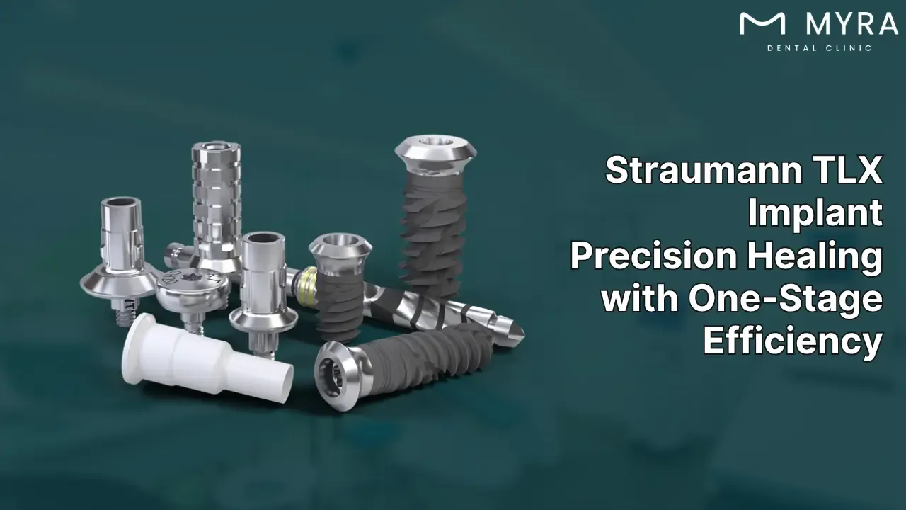 straumann-tlx-implant-system.webp