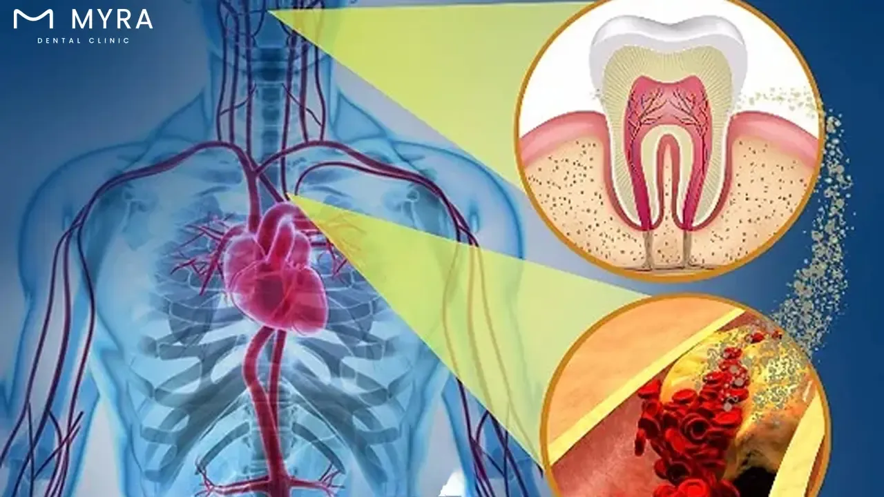 systemic health and implants