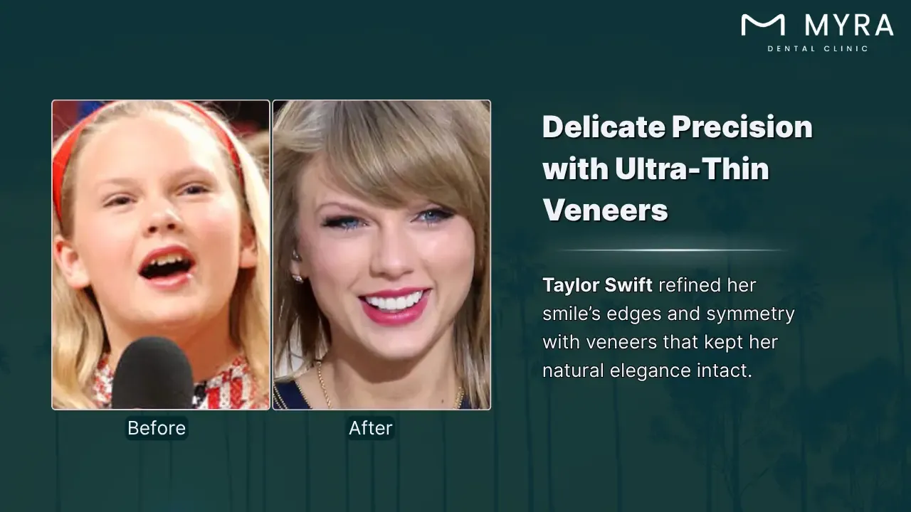taylor swift's flawless smile