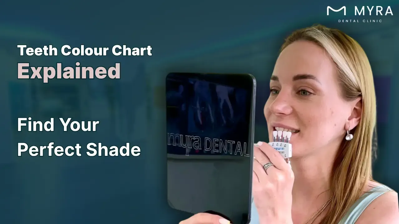 teeth colour chart: what shade are my teeth?