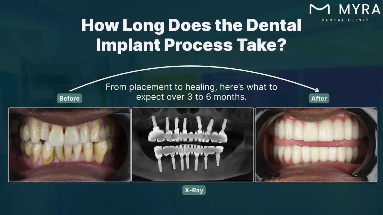 the process includes several stages over multiple months