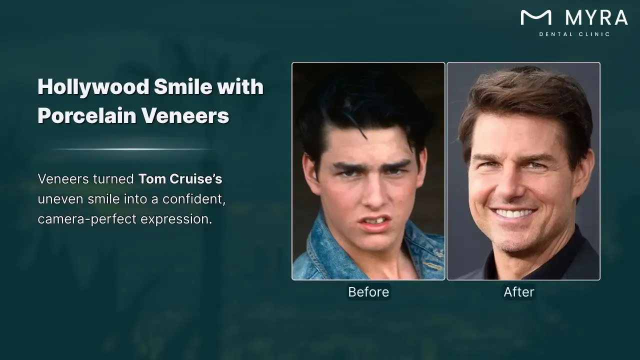 tom cruise's symmetrical smile