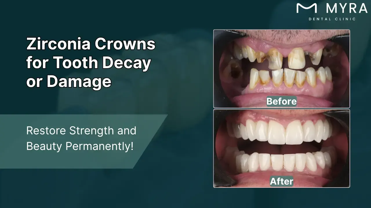 tooth decay or damage