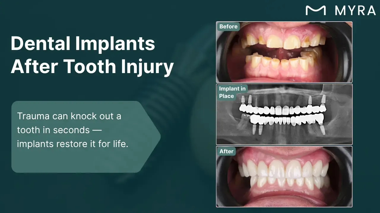 tooth-loss-from-injury.webp