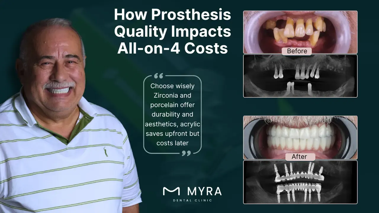 type-and-quality-of-prosthesis.webp
