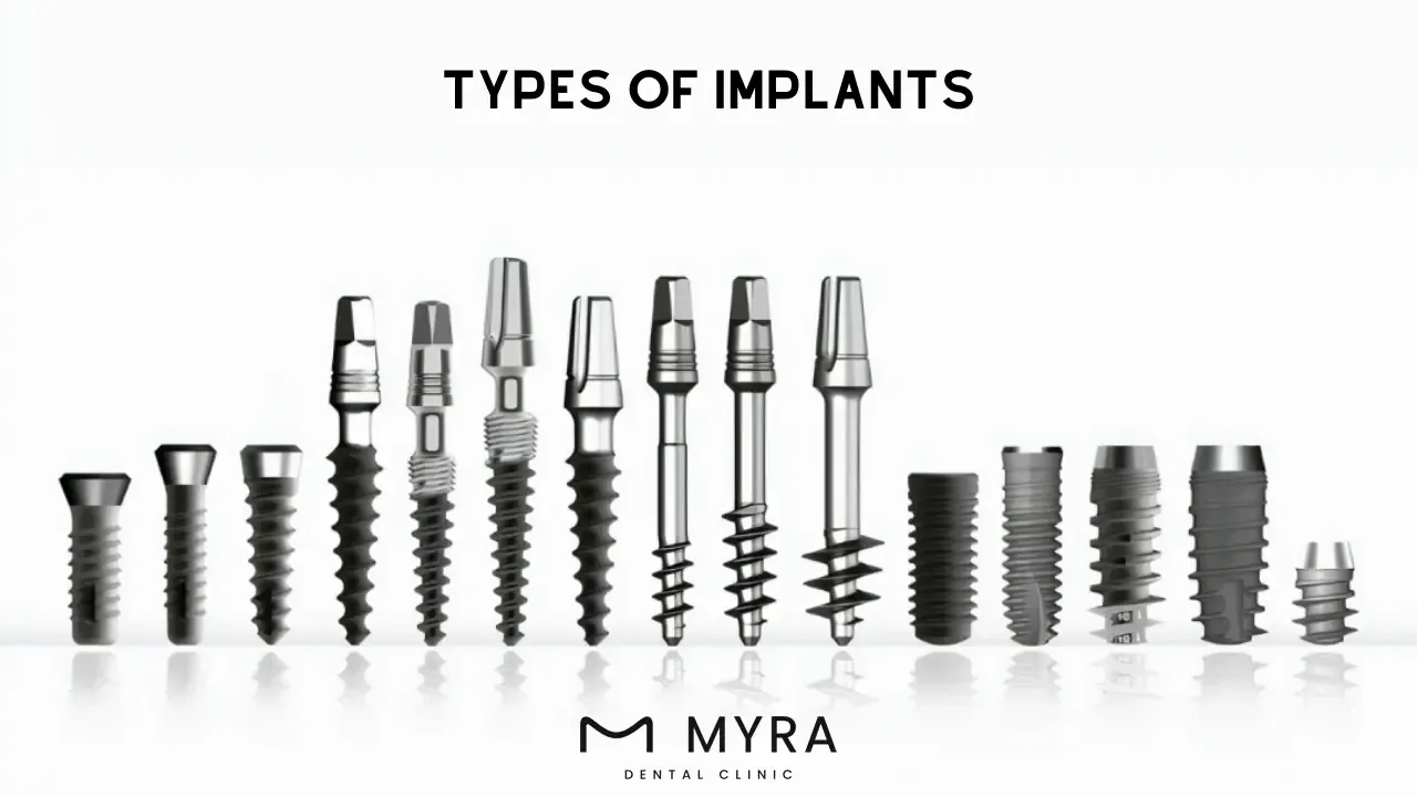 type of teeth implant