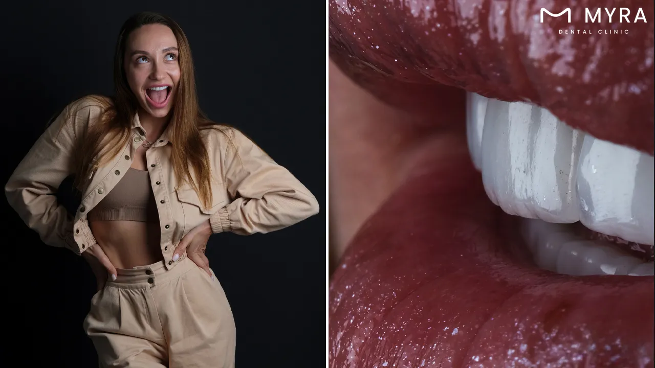 Unlocking 7 advantages of full-set veneers in turkey