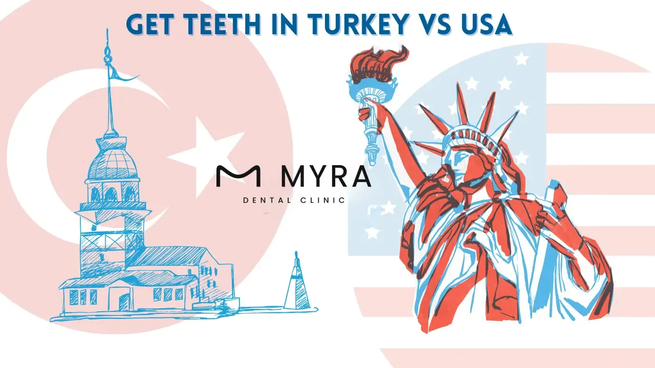 Veneers prices usa vs. turkey: Pros, cons, and comparisons