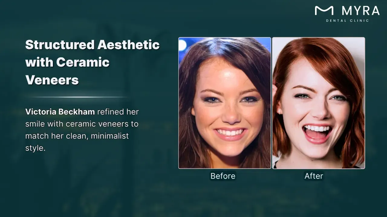 victoria beckham's designer smile