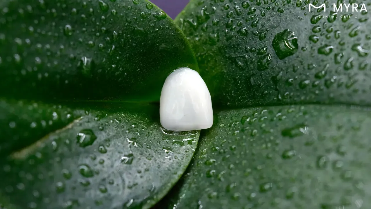 What are dental veneers