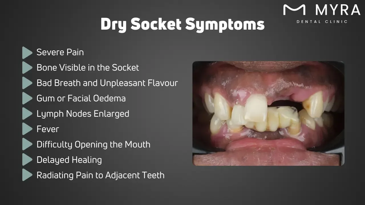 What are dry socket symptoms?