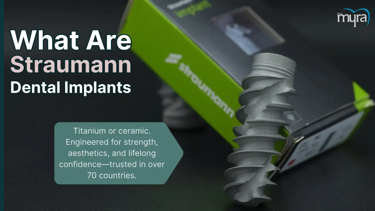 what-are-straumann-implants.webp