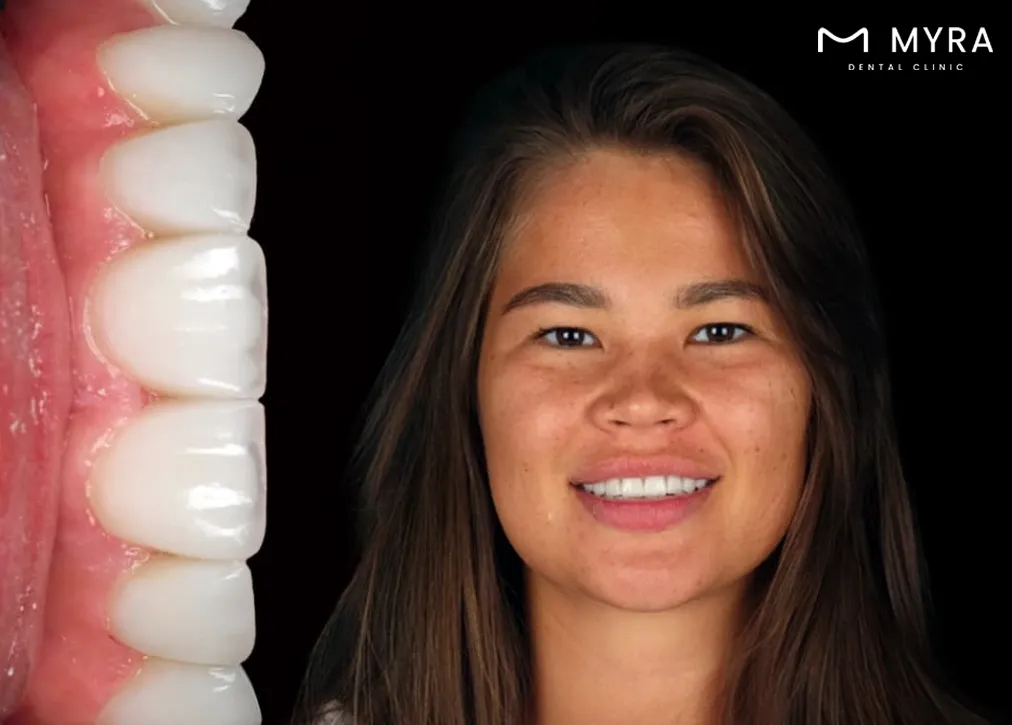 what are the advantages of choosing turkey for dental treatment?