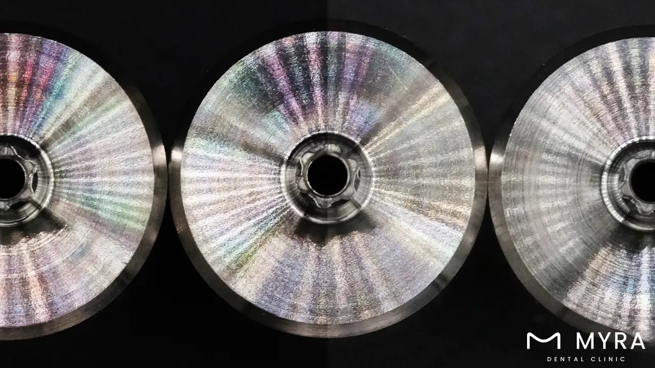 what are the advantages of prefabricated abutments?