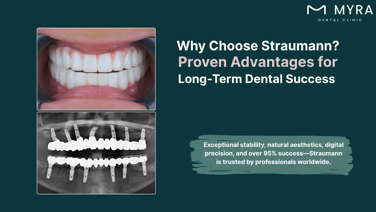 what-are-the-advantages-of-straumann-implants.webp
