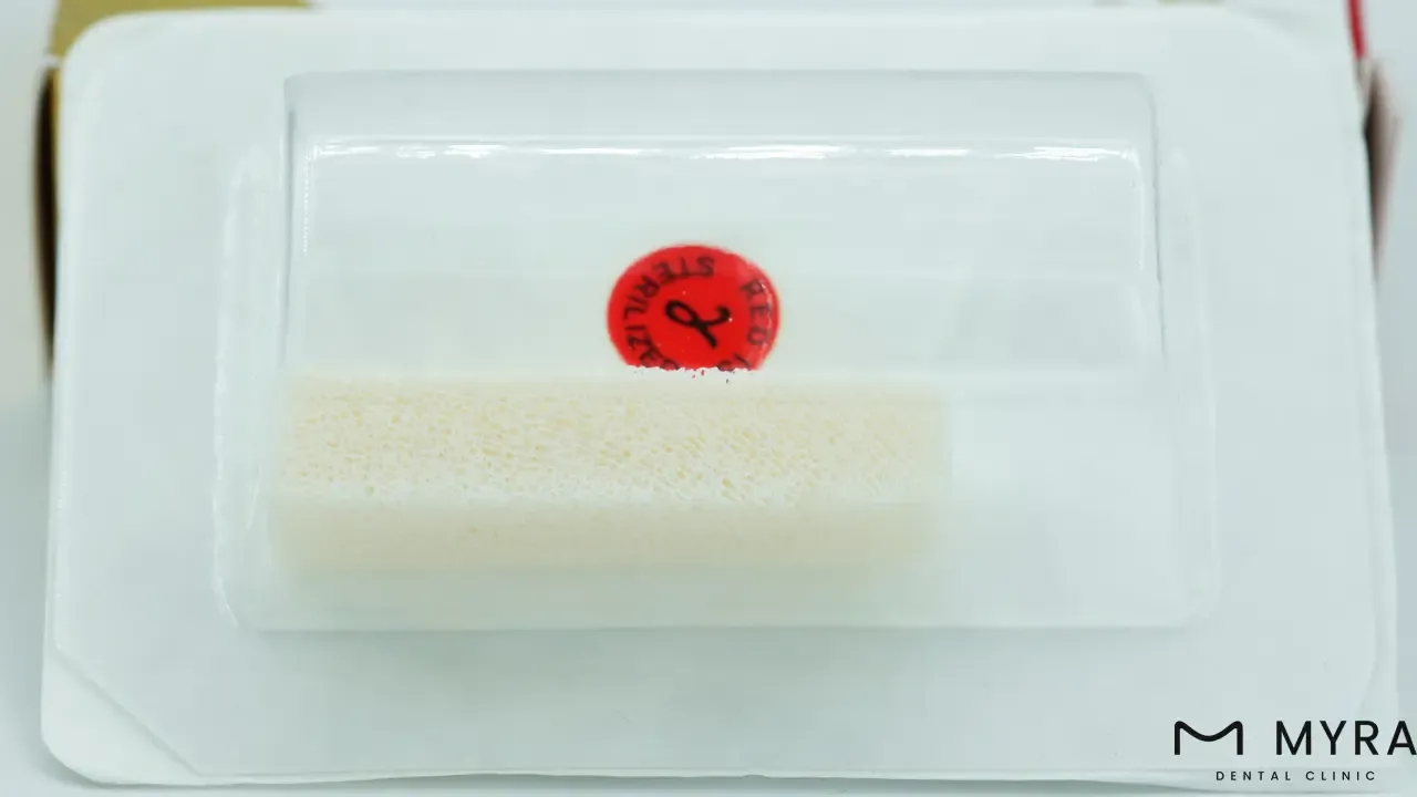 What are the advantages of the alloplast bone graft procedure?