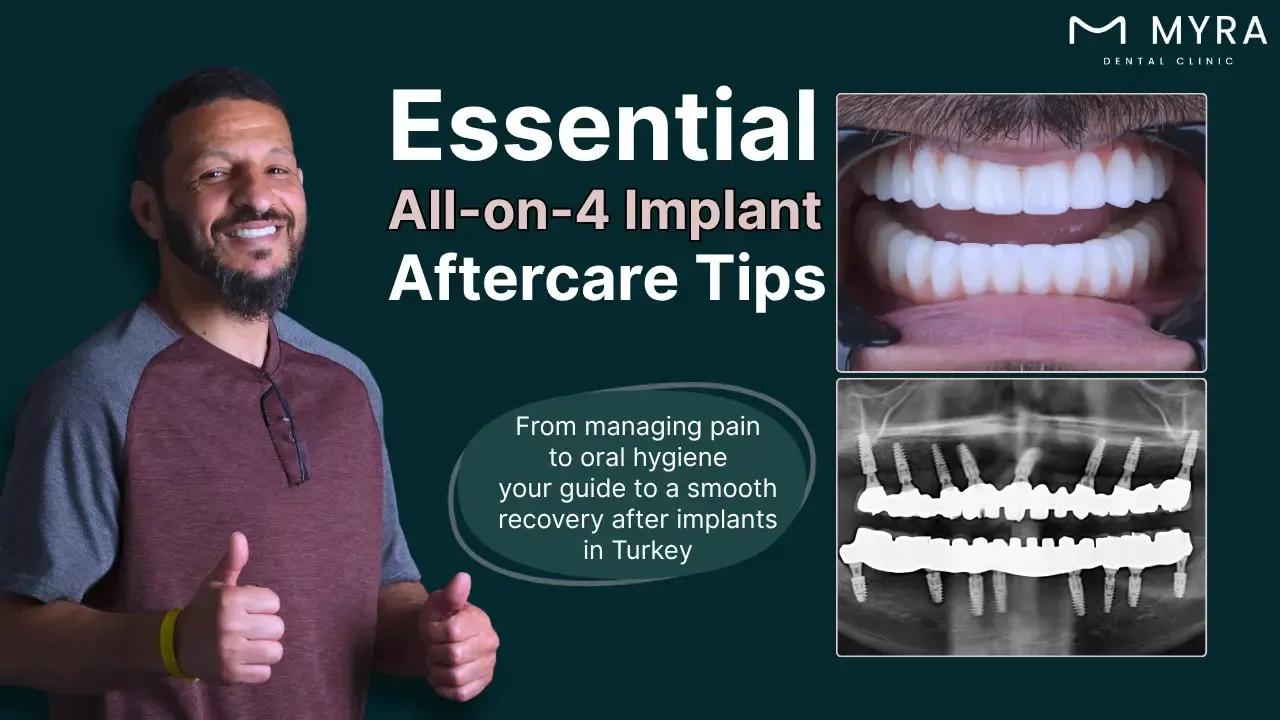 what-are-the-aftercare-requirements-after-getting-an-all-on-4-implant-in-turkey.webp