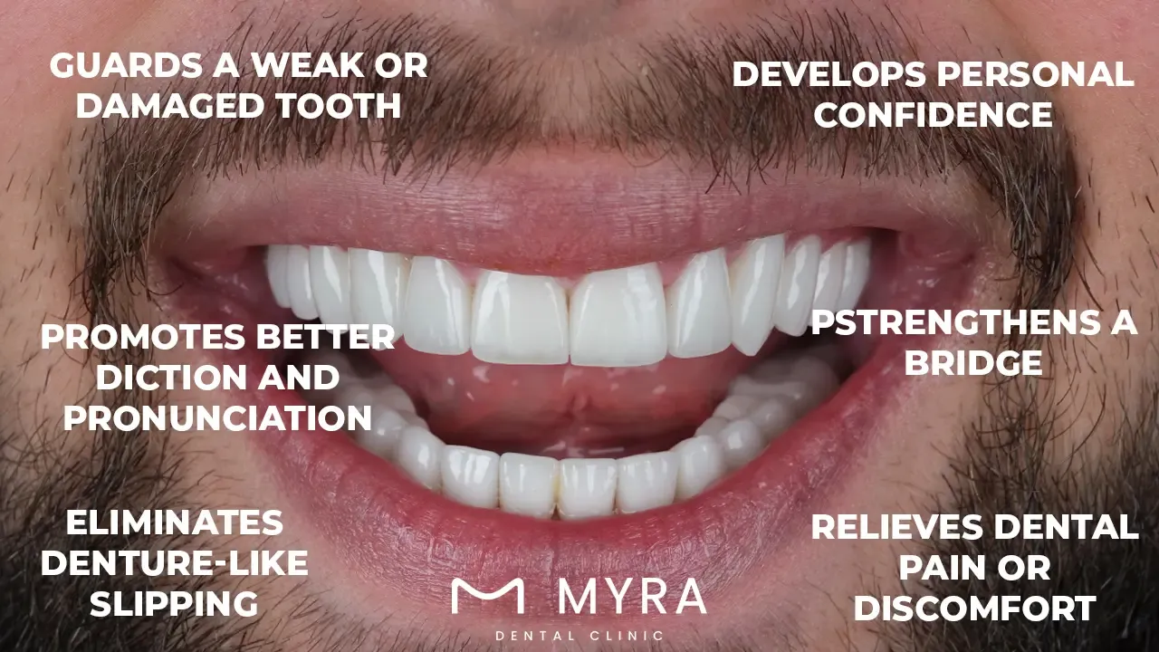 What are the benefits of dental crowns?