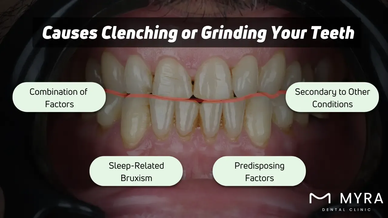 What are the causes of clenching or grinding your teeth?