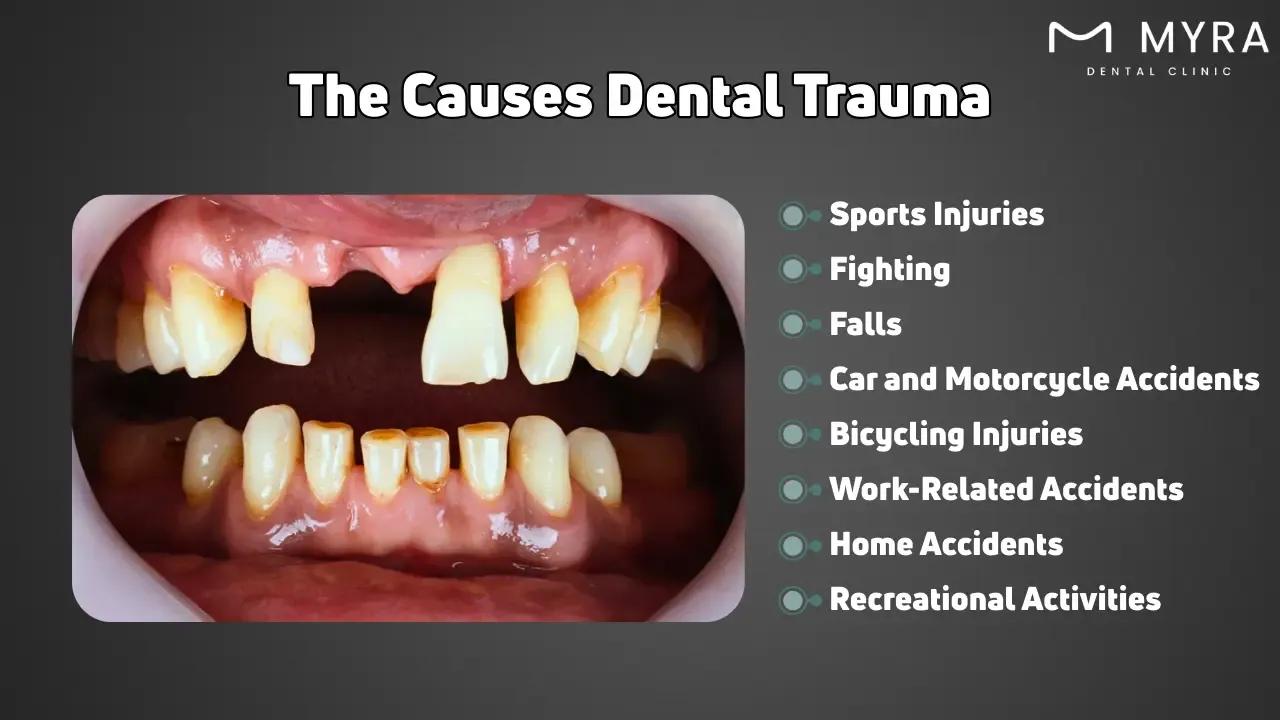 What are the causes of dental trauma?