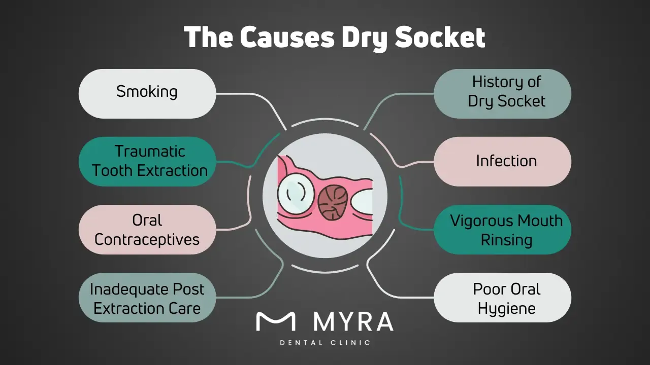 What are the causes of dry socket?